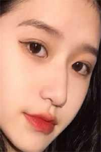 癫痫病是一种什么病?